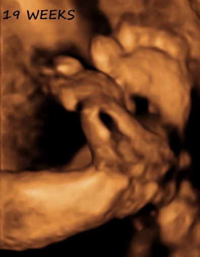 3D Second Third Trimester Obsterical Ultrasound - 19 Weeks
