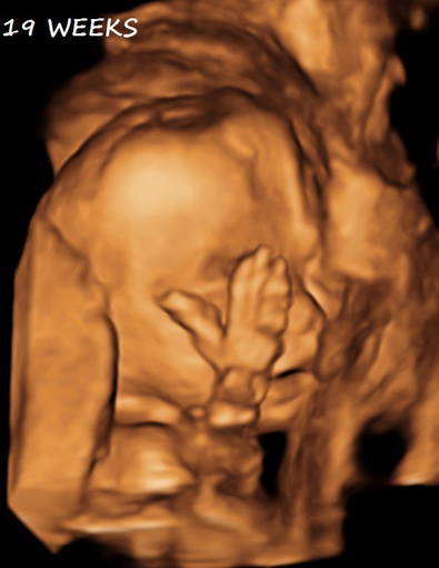 3D Second Third Trimester Obsterical Ultrasound - 19 Weeks