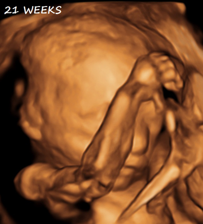 3D Second Third Trimester Obsterical Ultrasound - 21 Weeks