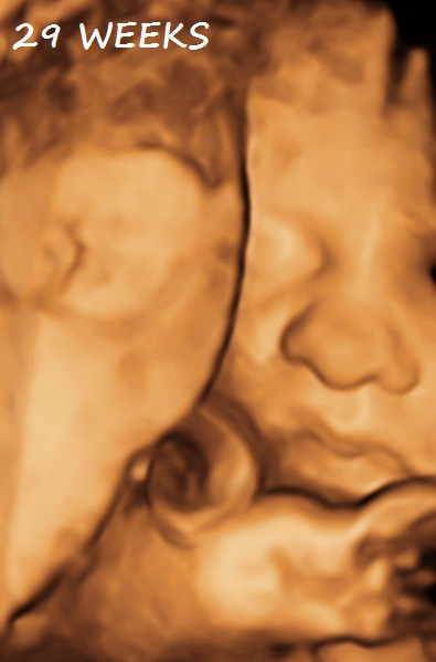 3D Second Third Trimester Obsterical Ultrasound - 29 Weeks