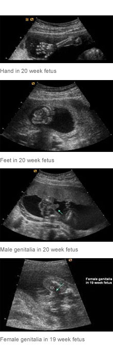 Second and Third Trimester Obsterical Ultrasound